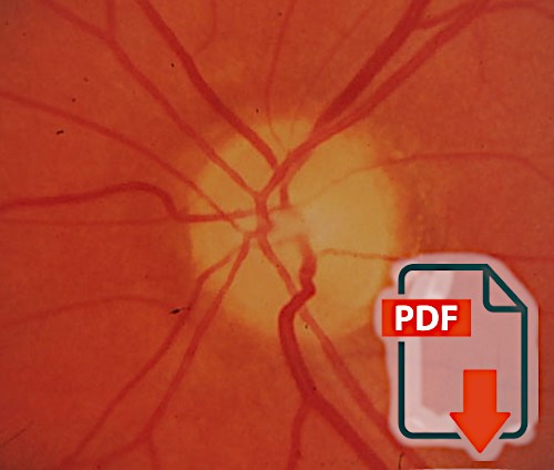 Ocular Vaspospasm in Children