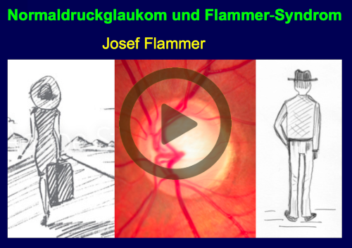 Flammer syndrome and glaucoma